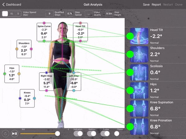 Gait recording example